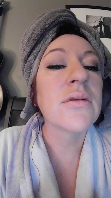 I Got Juvederm Lip Fillers – Here’s The Scoop (video)