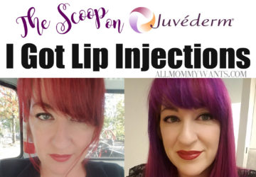 I Got Juvederm Lip Fillers – Here’s The Scoop (video)