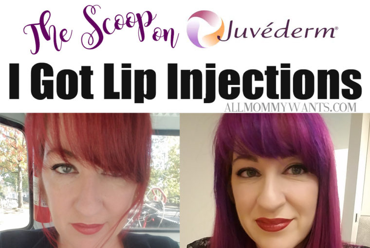 I Got Juvederm Lip Fillers – Here’s The Scoop (video)