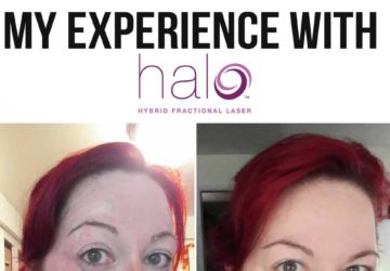 Is Halo Skin Treatment Right For You? My Experience With Dr. Bohley In Portland Oregon