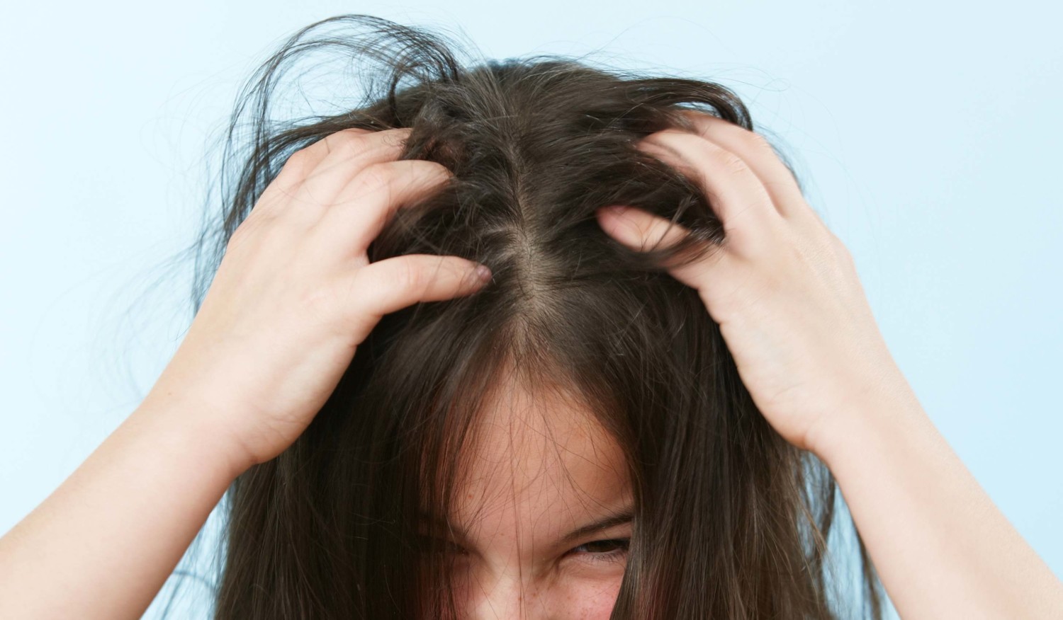Effectively Get Rid Of Super Lice Without Chemicals